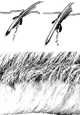 NatHist Hair Follicle