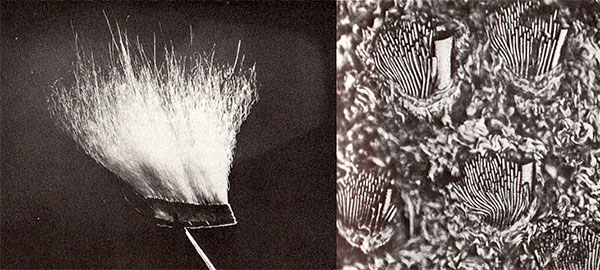 NatHist Hair Follicle